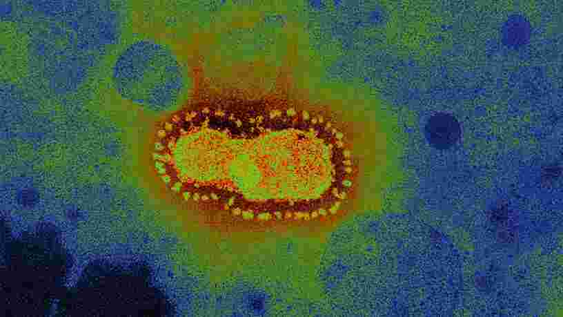 Des scientifiques australiens ont réussi à cultiver un échantillon de coronavirus de Wuhan