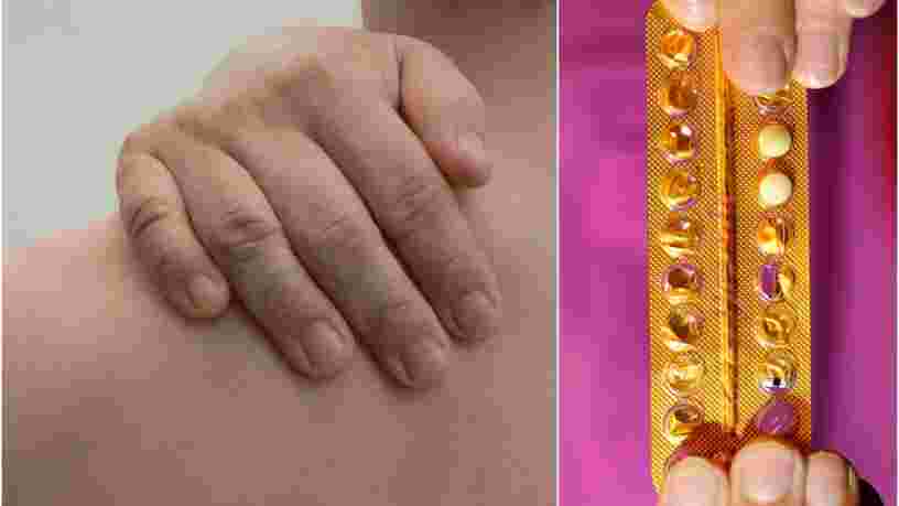 Le premier essai clinique de gel contraceptif pour hommes commence au Royaume-Uni et il pourrait être une alternative à la pilule
