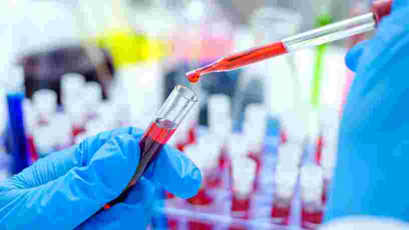 Un deuxième patient dans le monde atteint du virus du sida est déclaré guéri