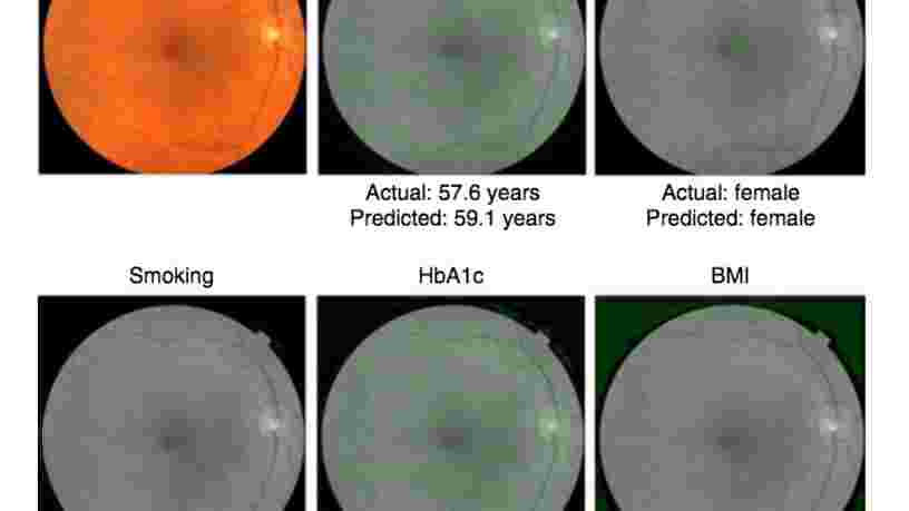 Google a développé une IA qui détecte les risques de maladies cardiaques en scannant les yeux