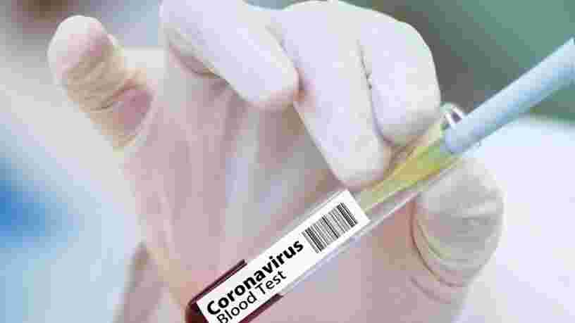 Un vaccin 'efficace à 90%' contre le Covid-19 doit faire l'objet d'une demande d'homologation d'ici fin novembre