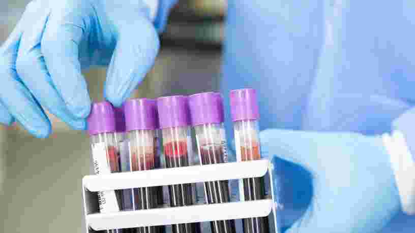 Sanofi compte supprimer de 300 à 600 postes en recherche et développement
