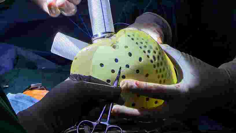 L'entreprise française Carmat a vendu pour la première fois un cœur artificiel en Italie