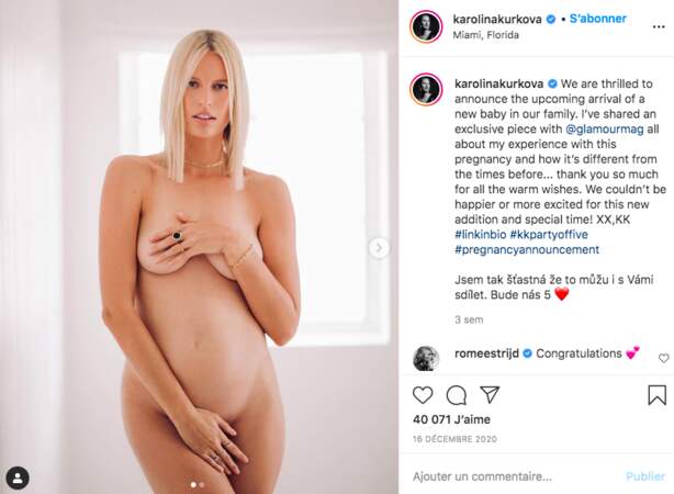 Karolina Kurkova est enceinte ! 