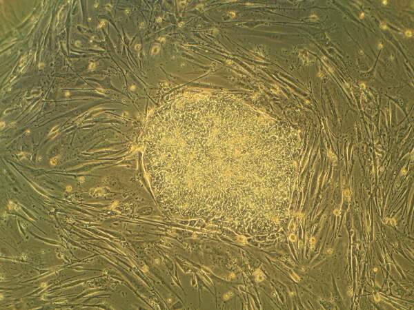 1981 Des chercheurs identifient des cellules souches embryonnaires chez la souris...
