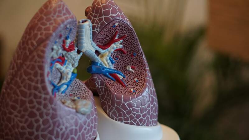 90% des cancers du poumon en France sont liés à un tabagisme actif
